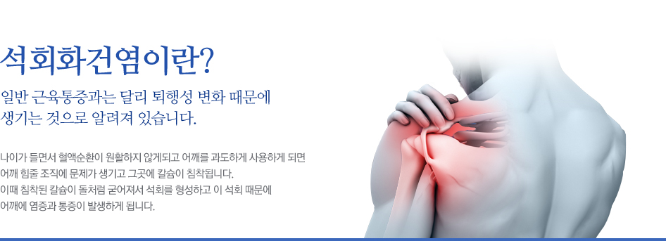 석회화건염이란? 일반 근육통증과는 달리 퇴행성 변화 때문에 생기는 것으로 알려져 있습니다. 나이가 들면서 혈액순환이 원활하지 않게되고 어깨를 과도하게 사용하게 되면 어깨 힘줄 조직에 문제가 생기고 그곳에 칼슘이 침착됩니다. 이때 침착된 칼슘이 돌처럼 굳어져서 석회를 형성하고 이 석회 때문에 어깨에 염증과 통증이 발생하게 됩니다.