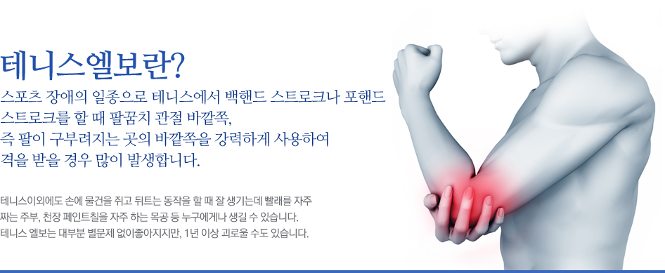 테니스엘보란? 스포츠 장애의 일종으로 테니스에서 백핸드 스트로크나 포핸드 스트로크를 할 때 팔꿈치 관절 바깥쪽, 즉 팔이 구부려지는 곳의 바깥쪽을 강력하게 사용하여 격을 받을 경우 많이 발생합니다. 테니스이외에도 손에 물건을 쥐고 뒤트는 동작을 할 때 잘 생기는데 빨래를 자주짜는 주부, 천장 페인트칠을 자주 하는 목공 등 누구에게나 생길 수 있습니다. 테니스 엘보는 대부분 별문제 없이좋아지지만, 1년 이상 괴로울 수도 있습니다.