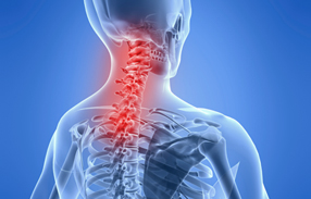 거북목 증후군의 증상 이미지