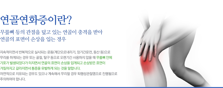 연골연화증이란? 무릎뼈 등의 관절을 덮고 있는 연골이 충격을 받아 연골의 표면이 손상을 입는 경우 지속적이면서 반복적으로 실시되는 운동(계단오르내리기, 장기간운전, 등산 등)으로 무리를 하게되는 경우 또는 골절, 탈구 등으로 오랜기간 사용하지 않을 때 무릎뼈 안에 기포가 발생되었다가 터지면서 연골의 표면이 손상을 입게되고 손상받은 표면이 거칠어지고 갈라지면서 통증을 유발하게 되는 것을 말합니다. 자연적으로 치유되는 경우도 있으나 계속해서 무리할 경우 퇴행성관절염으로 진행됨으로 주의하여야 합니다.