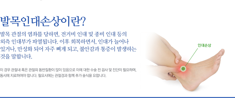 발목인대손상이란? 발목 관절의 염좌를 당하면, 전거비 인대 및 종비 인대 등의 외측 인대부가 파열됩니다. 이후 회복하면서, 인대가 늘어나 있거나, 만성화 되어 자주 삐게 되고, 불안감과 통증이 발생하는 것을 말합니다.