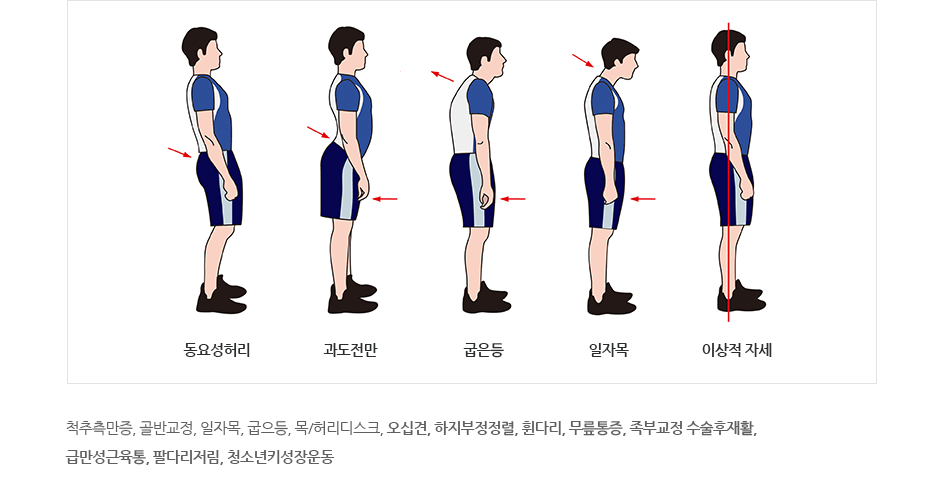 척추측만증, 골반교정, 일자목, 굽으등, 목/허리디스크, 오십견, 하지부정정렬, 휜다리, 무릎통증, 족부교정 수술후재활, 급만성근육통, 팔다리저림, 청소년키성장운동