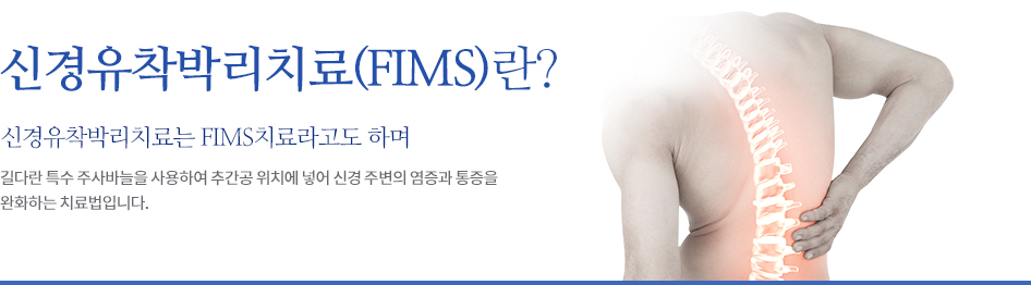 신경주사치료란 ?