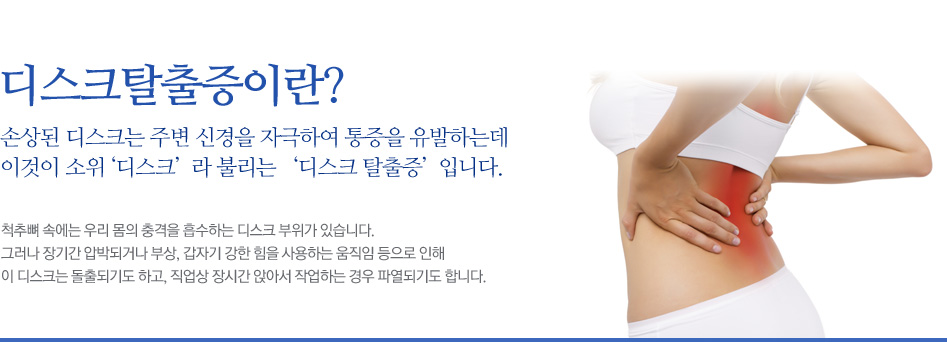 디스크탈출증이란? 손상된 디스크는 주변 신경을 자극하여 통증을 유발하는데 이것이 소위 ‘디스크’ 라 불리는 ‘디스크 탈출증’ 입니다. 척추뼈 속에는 우리 몸의 충격을 흡수하는 디스크 부위가 있습니다. 그러나 장기간 압박되거나 부상, 갑자기 강한 힘을 사용하는 움직임 등으로 인해 이 디스크는 돌출되기도 하고, 직업상 장시간 앉아서 작업하는 경우 파열되기도 합니다.