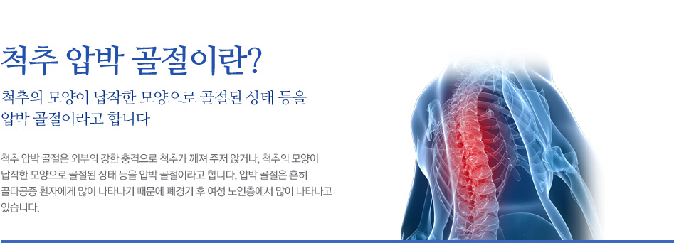 척추 압박 골절이란? 척추의 모양이 납작한 모양으로 골절된 상태 등을 압박 골절이라고 합니다. 척추 압박 골절은 외부의 강한 충격으로 척추가 깨져 주저 앉거나, 척추의 모양이 납작한 모양으로 골절된 상태 등을 압박 골절이라고 합니다, 압박 골절은 흔히 골다공증 환자에게 많이 나타나기 때문에 폐경기 후 여성 노인층에서 많이 나타나고 있습니다.