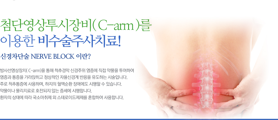 방사선영상장치( C-arm)을 통해 척추경막 신경주위 염증에 직접 약물을 투여하여
염증과 통증을 가라앉히고 정상적인 자율신경계 반응을 유도하는 시술입니다.
주로 척추통증에 사용하며, 하지의 혈액순환 장애에도 시행할 수 있습니다.
약물이나 물리치료로 호전되지 않는 증세에 시행합니다.
환자의 상태에 따라 국소마취제 외 스테로이드제제를 혼합하여 사용합니다.