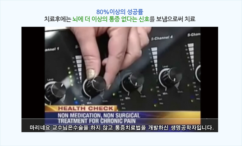 페인스크램블러 치료 사진 3