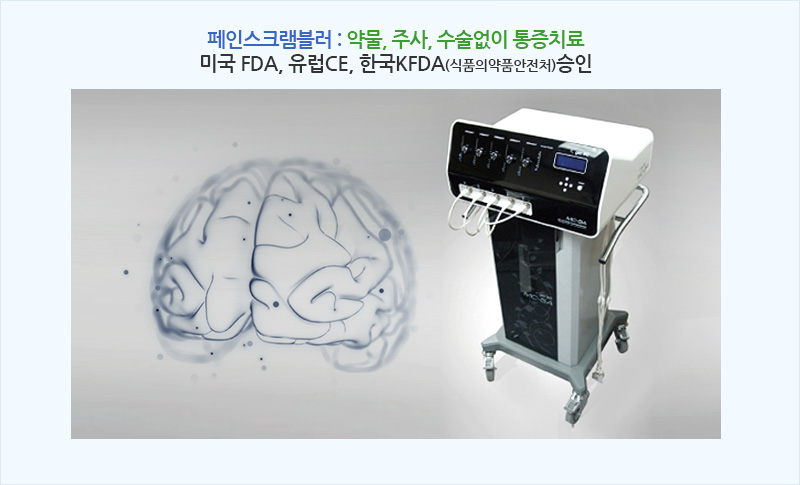 페인스크램블러 치료 사진 1